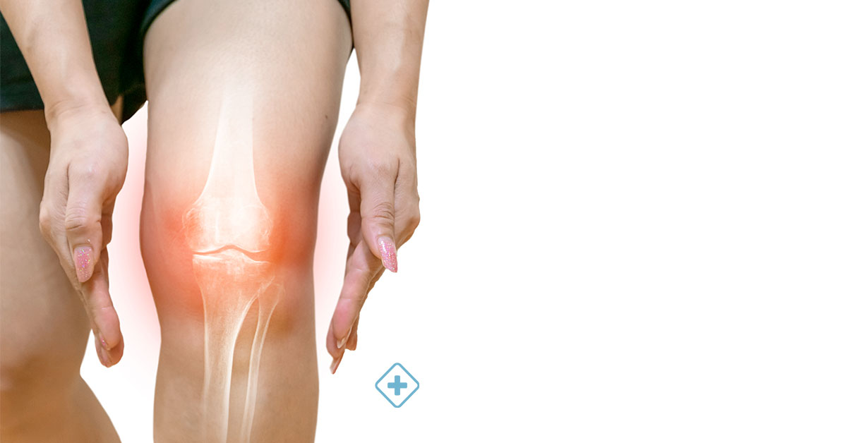 Osteoporosis: síntomas, causas, diagnóstico y tratamiento